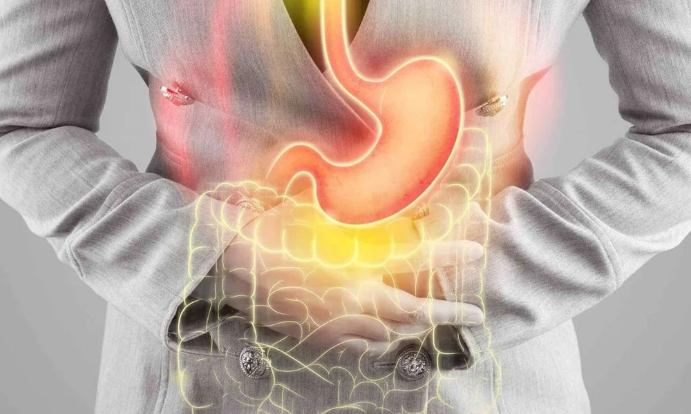 reflux 2