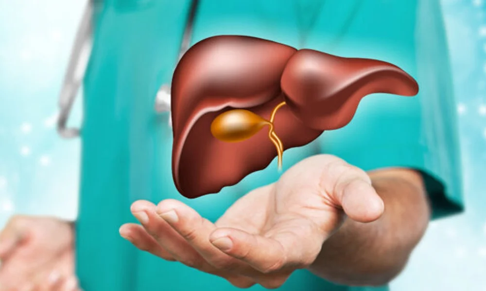 gallbladder stones 3
